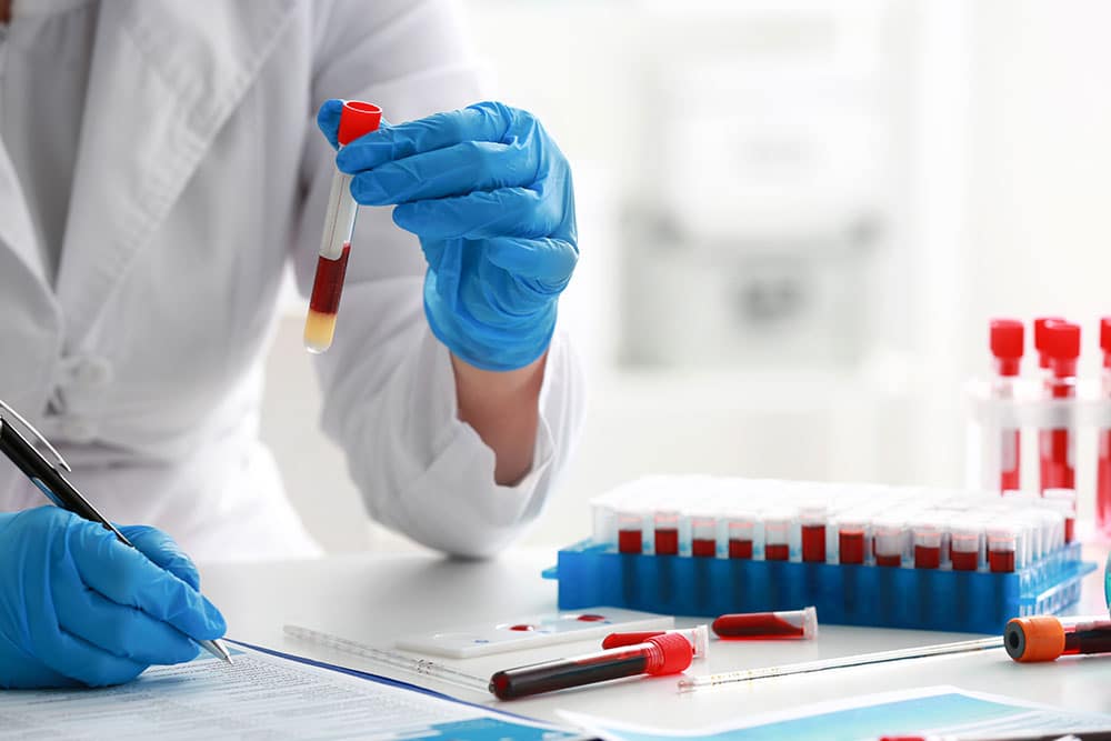 Veterinary technician performing blood sample analysis for pet diagnostic testing in a laboratory